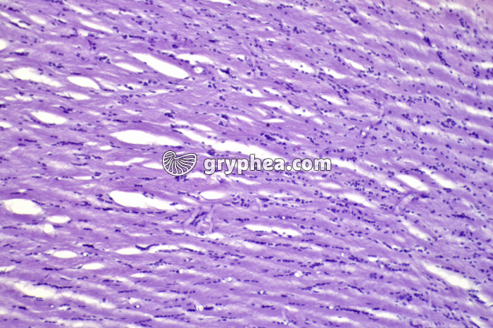 Plexus choroïde x100 - gryphea.org